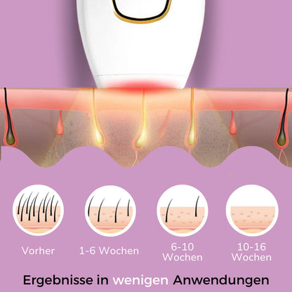 Ylvis IPL Hair Remover - Nanorasierer für seidig glatte Haut in Sekunden