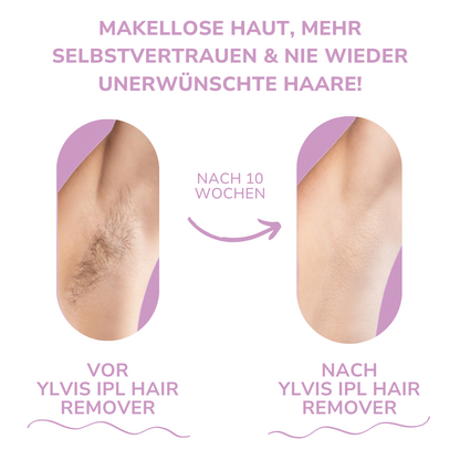 Ylvis IPL Hair Remover - Nanorasierer für seidig glatte Haut in Sekunden